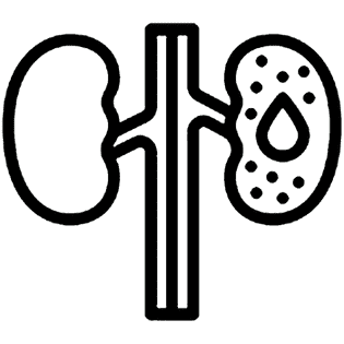 Pyelonephritis Treatment